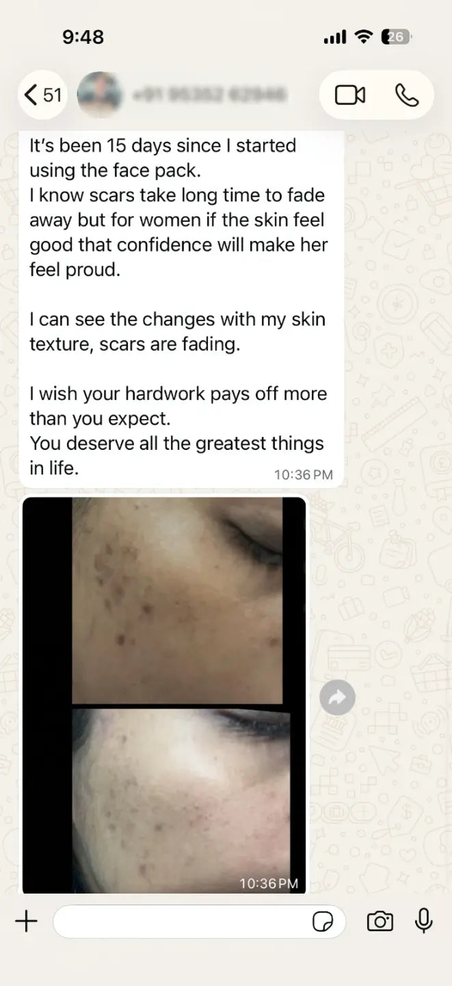Instagram Image
